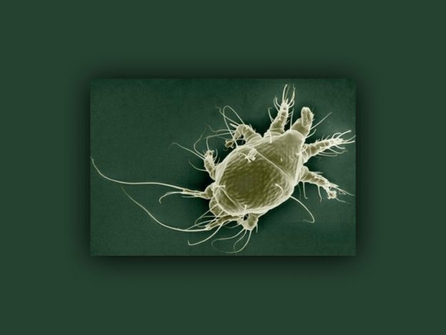 apisantos epragas Acarapisose apisantos epragas Acarapisose